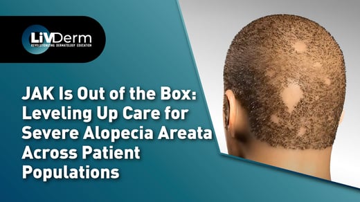 JAK Is Out of the Box: Leveling Up Care for Severe Alopecia Areata Across Patient Populations