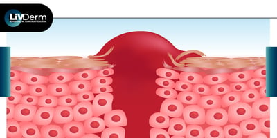 LiVDerm ENERO 123020-06