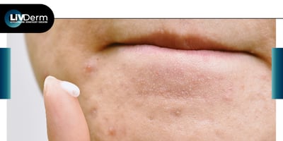 LiVDerm September 090120-03