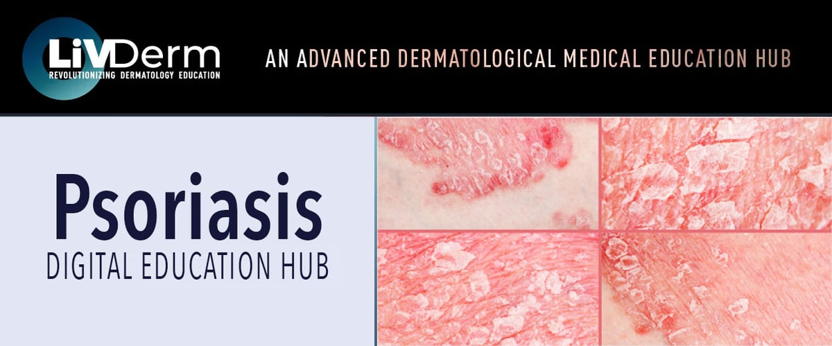 Psoriasis Digital Education Hub