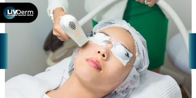 FDA Clears the Accure Laser System for the Treatment of Mild to Severe Inflammatory Acne Vulgaris