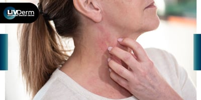 Age-Related Atopic Dermatitis Phenotypes Evaluated in Study
