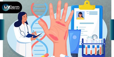 Study Finds JAK Inhibitors Safer Than Other Systemic Agents