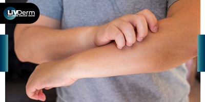 Dupixent (dupilumab) approved by FDA as the first and only treatment indicated for prurigo nodularis